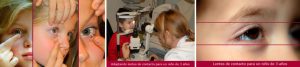 Adaptando lentes de contacto a niños
