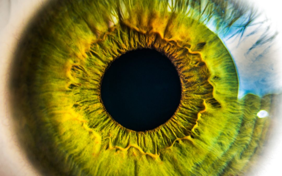 ¿Se puede controlar la miopía con lentes blandas en casos de miopía y astigmatismo?